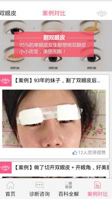 双眼皮咨询APP截图