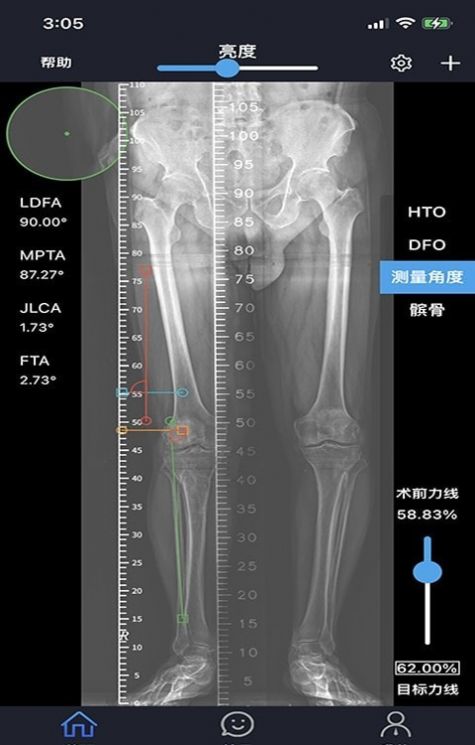 华保膝望截图